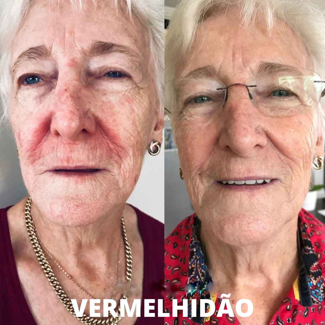 Óleo Facial Glory Oil