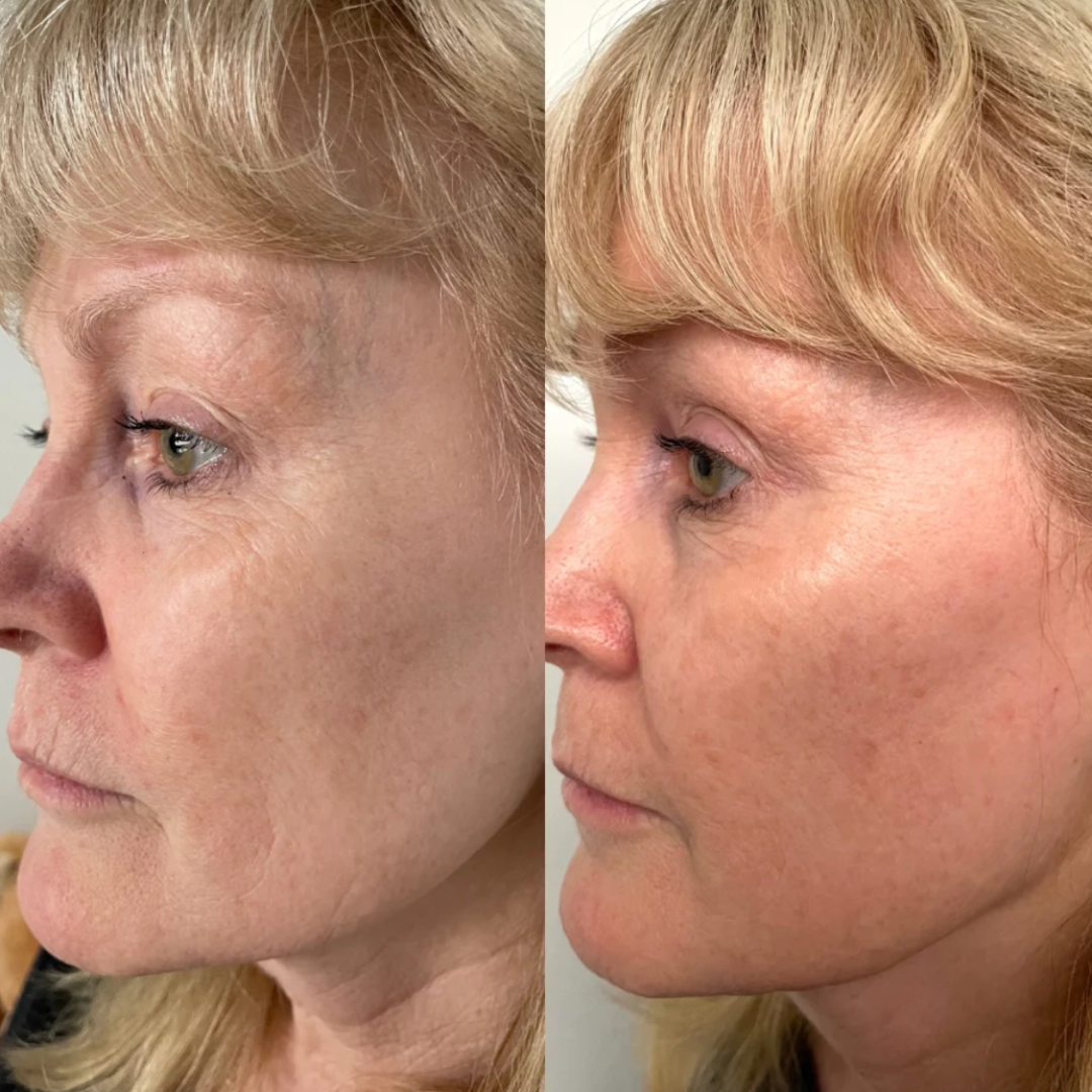 Sérum Anti-Envelhecimento